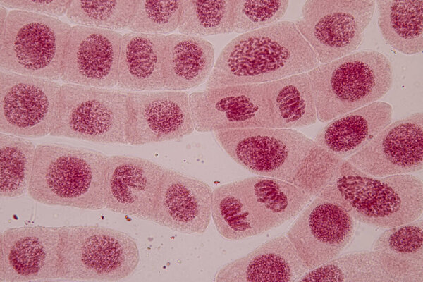 Root tip of Onion and Mitosis cell in the Root tip of Onion under a microscope.