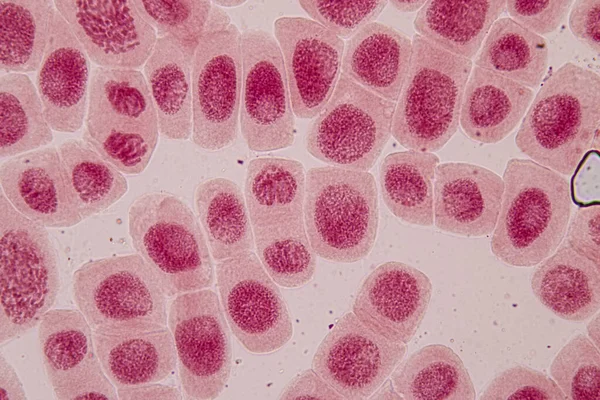 Punta Raíz Cebolla Mitosis Punta Raíz Cebolla Bajo Microscopio — Foto de Stock