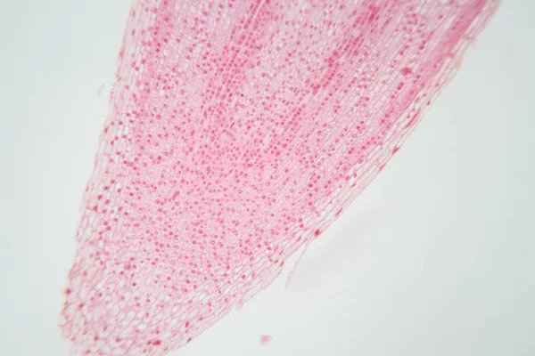 Ponta Raiz Célula Cebola Mitose Ponta Raiz Cebola Sob Microscópio — Fotografia de Stock