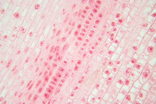 Korzeń Końcówki Cebuli Komórek Mitozy Korzeniowej Końcówce Cebuli Pod Mikroskopem — Zdjęcie stockowe