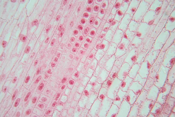 Korzeń Końcówki Cebuli Komórek Mitozy Korzeniowej Końcówce Cebuli Pod Mikroskopem — Zdjęcie stockowe