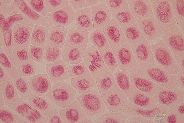 Root tip of Onion and Mitosis cell in the Root tip of Onion under a microscope.