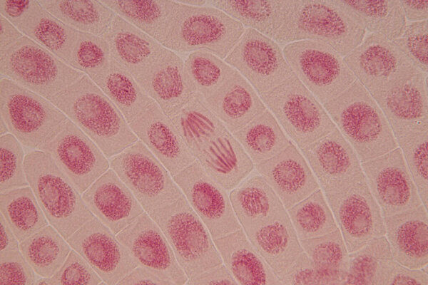 Root tip of Onion and Mitosis cell in the Root tip of Onion under a microscope.