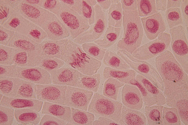 Root tip of Onion and Mitosis cell in the Root tip of Onion under a microscope.
