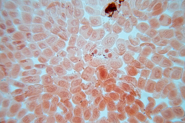 Root tip of Onion and Mitosis cell in the Root tip of Onion under a microscope.