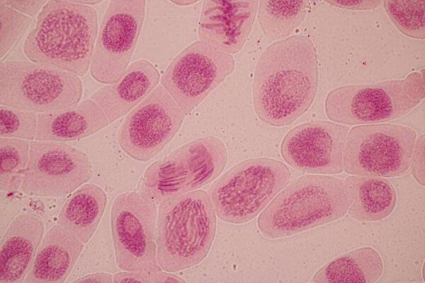 Root tip of Onion and Mitosis cell in the Root tip of Onion under a microscope.