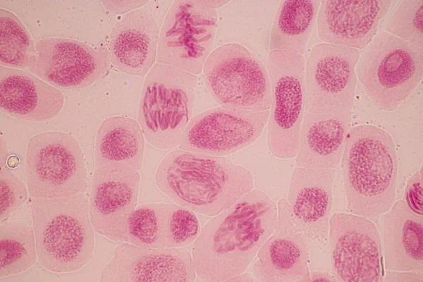 Punta Raíz Cebolla Mitosis Punta Raíz Cebolla Bajo Microscopio — Foto de Stock