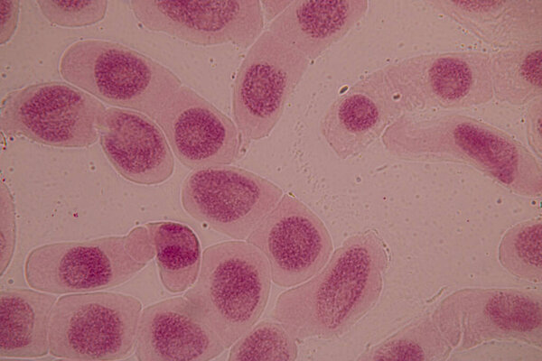 Root tip of Onion and Mitosis cell in the Root tip of Onion under a microscope.