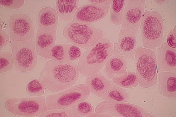 Špička Kořenové Cibule Mitózy Kořenové Špičce Cibule Pod Mikroskopem — Stock fotografie