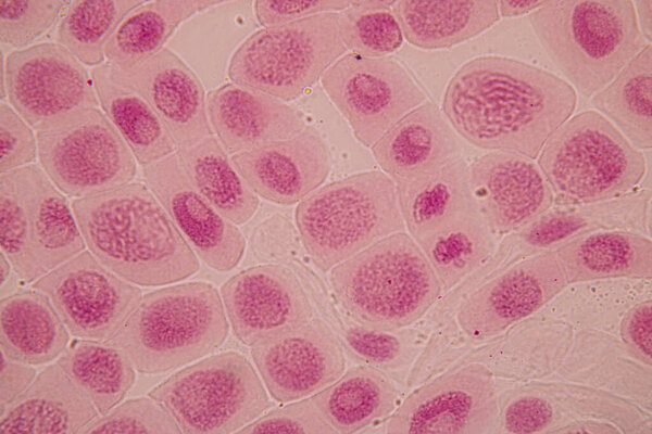 Root tip of Onion and Mitosis cell in the Root tip of Onion under a microscope.