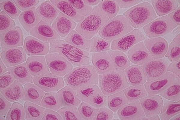 Root tip of Onion and Mitosis cell in the Root tip of Onion under a microscope.