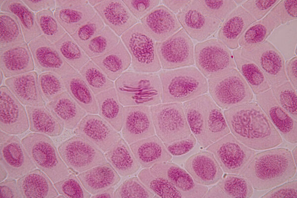 Root tip of Onion and Mitosis cell in the Root tip of Onion under a microscope.