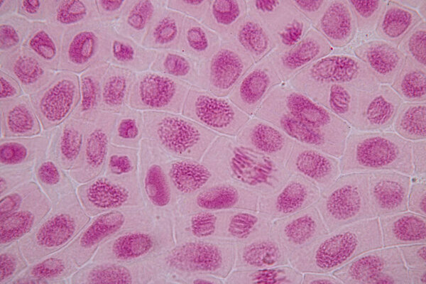 Root tip of Onion and Mitosis cell in the Root tip of Onion under a microscope.