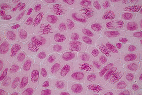 Root tip of Onion and Mitosis cell in the Root tip of Onion under a microscope.