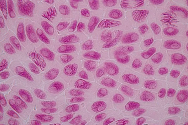 Punta Raíz Cebolla Mitosis Punta Raíz Cebolla Bajo Microscopio —  Fotos de Stock