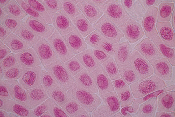 Root tip of Onion and Mitosis cell in the Root tip of Onion under a microscope.