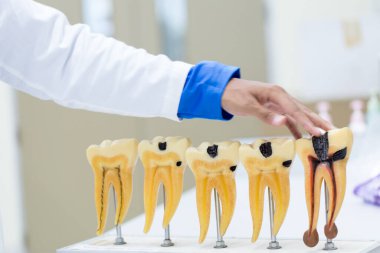 Sınıf eğitimi ve laboratuvar için diş modeli.