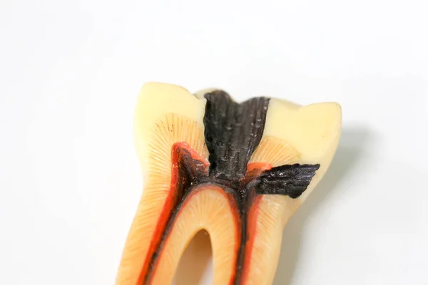 Sınıf Eğitimi Laboratuvar Için Diş Modeli — Stok fotoğraf