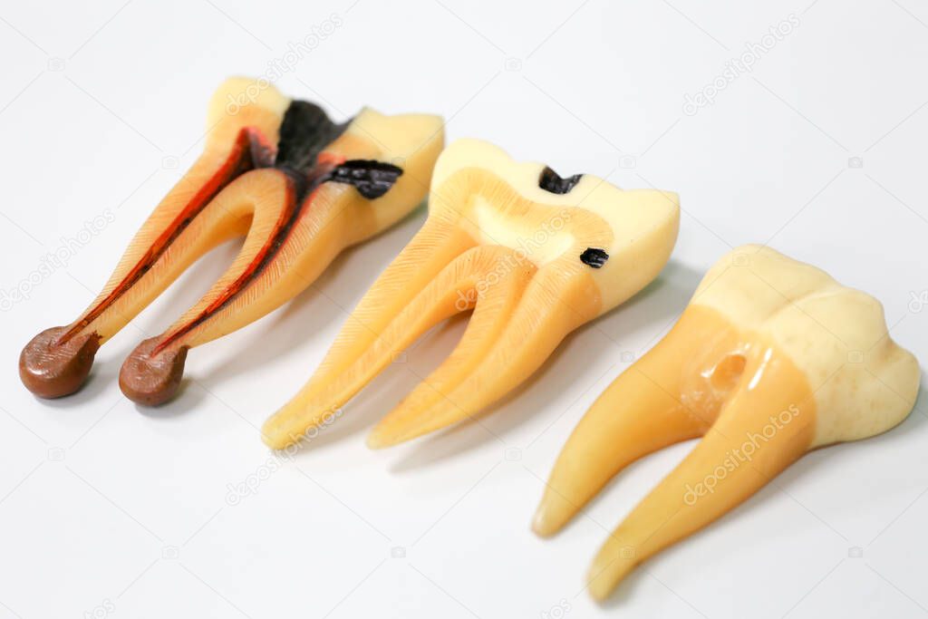 Tooth model for classroom education and in laboratory.