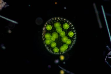 Volvox, sınıf eğitimi için mikroskop altında su damlasında.