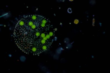 Volvox, sınıf eğitimi için mikroskop altında su damlasında.