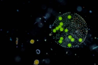 Volvox, sınıf eğitimi için mikroskop altında su damlasında.