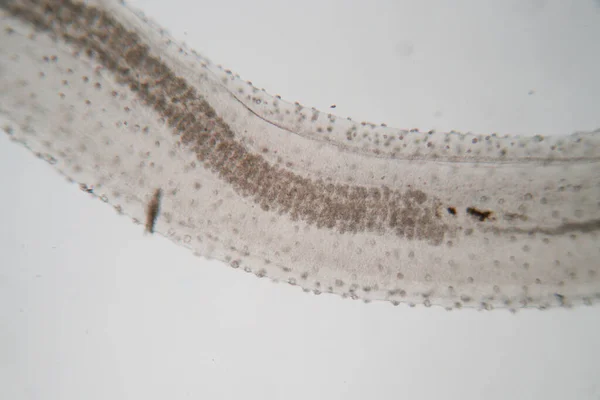 Studie Parasiet Wormen Een Zoetwatervis Parasiet Het Laboratorium Voor Onderwijs — Stockfoto