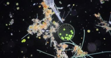 Volvox, sınıf eğitimi için mikroskop altında su damlasında.