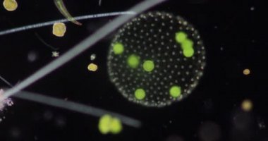 Volvox, sınıf eğitimi için mikroskop altında su damlasında.