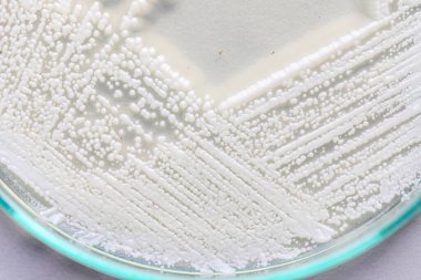 Petri kabında maya, laboratuvarlarda eğitim için mikrobiyoloji.