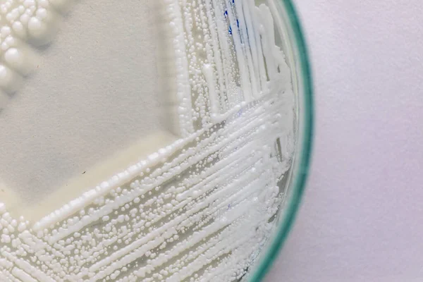 Élesztő Petri Csészében Mikrobiológia Laboratóriumokban Történő Oktatáshoz — Stock Fotó