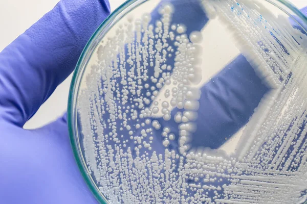 Élesztő Petri Csészében Mikrobiológia Laboratóriumokban Történő Oktatáshoz — Stock Fotó
