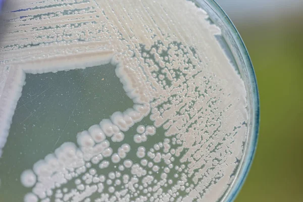 Levedura Placa Petri Microbiologia Para Educação Laboratórios — Fotografia de Stock