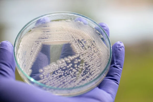 Kvasinky Petriho Misce Mikrobiologie Pro Výuku Laboratořích — Stock fotografie