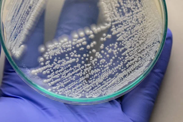 Petri kabında maya, laboratuvarlarda eğitim için mikrobiyoloji.