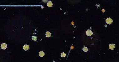 Glenodinium eğitim için mikroskop altında.