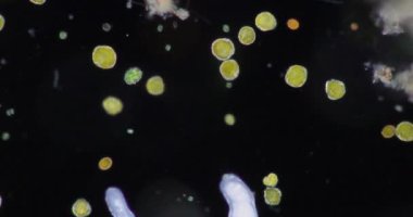 Glenodinium eğitim için mikroskop altında.