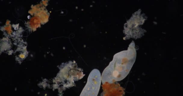Loxodes Rod Karyorelicteanských Ciliátů Který Patří Čeledi Loxodidae Pod Mikroskopem — Stock video