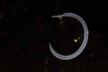 Şistozom, trematod cinsi. Laboratuvarda eğitim için kan rastlantısı olarak bilinir..