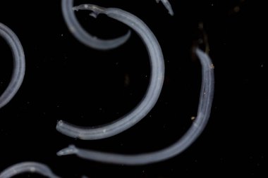 Şistozom, trematod cinsi. Laboratuvarda eğitim için kan rastlantısı olarak bilinir..