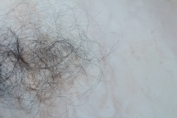 Hair fall problem. Hair on marble background. Hair care and beauty concepts.