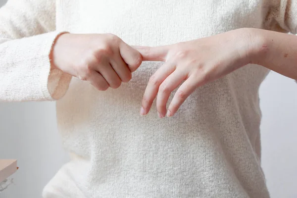 Mulher Jovem Que Sofre Dor Nas Articulações Das Mãos Dos — Fotografia de Stock