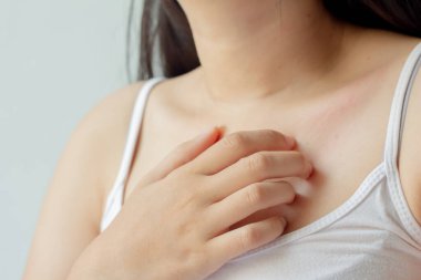 Göğsündeki ve boynundaki kaşıntıyı kaşıyan genç bir kadın. Cildindeki kaşıntıya böcek ısırıkları, deri iltihabı, yemek ve uyuşturucu alerjisi neden olur. Sağlık hizmeti kavramı.