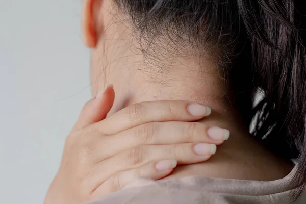 Mujer Joven Tiene Erupción Cutánea Espalda Cuello Sobre Fondo Blanco — Foto de Stock