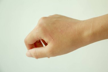 İnsan eli kediyi tırmalamış.