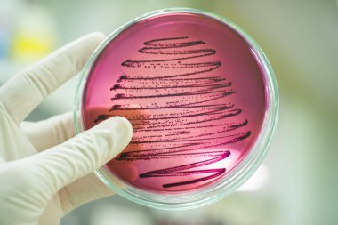 Bakteri hücreleri ve arka plan bulanıklığı olan bir Petri Çanağı tutan bir bilim adamı..