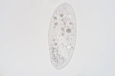 Paramessiyum, tek hücreli bir protozoa cinsidir ve genellikle ciliate grubunun bir temsilcisi olarak incelenir. Paramecia tatlı su, tuzlu su ve deniz ortamlarında yaygındır ve sık sık durgun havuz ve havuzlarda boldur..