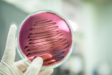 Bakteri hücreleri ve arka plan bulanıklığı olan bir Petri Çanağı tutan bilim adamı.