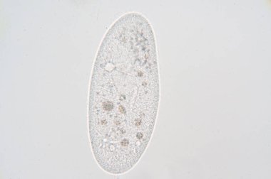 Paramessiyum, tek hücreli bir protozoa cinsidir ve genellikle ciliate grubunun bir temsilcisi olarak incelenir. Paramecia tatlı su, tuzlu su ve deniz ortamlarında yaygındır ve sık sık durgun havuz ve havuzlarda boldur..