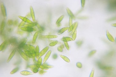 Euglena tek hücreli kırbaçlanmış ökaryotların bir cinsidir..